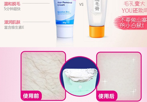 脱毛膏脱毛