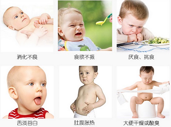 宝宝上火症状