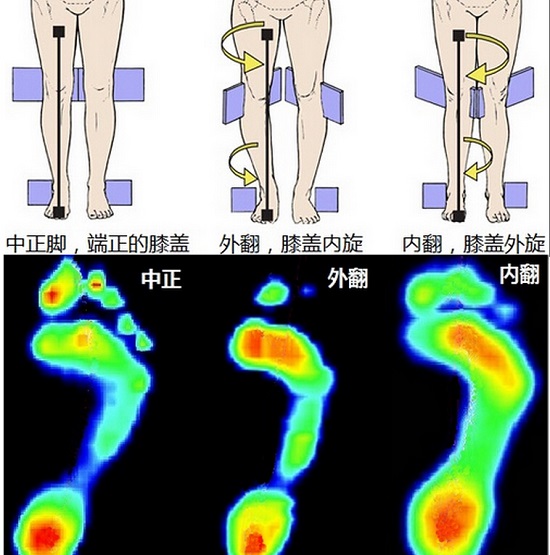 跑步姿势问题（部分）