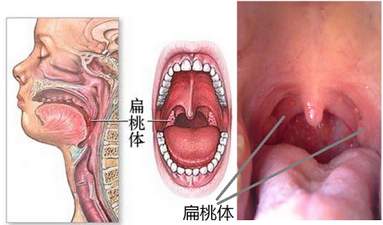 呼吸道疾病