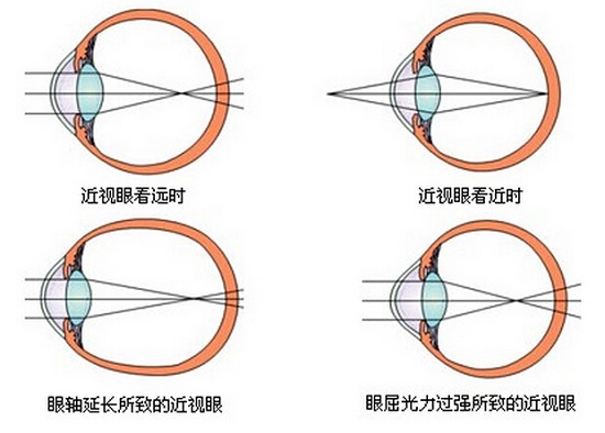 电子竞技入亚