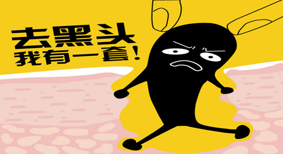 去黑头