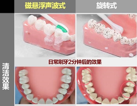 电动牙刷的清洁效果