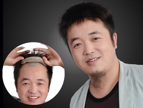 假发的固定