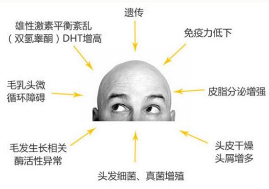 可能会导致脱发的原因