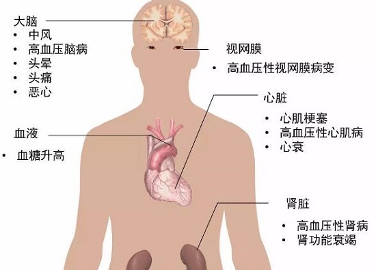 高血压引起的其他健康问题