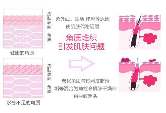 毛孔堵塞引发的问题