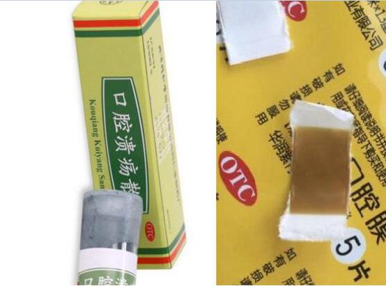 口腔溃疡散