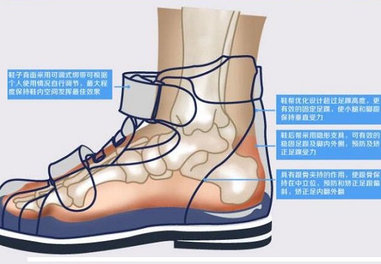 机能鞋的主要功能