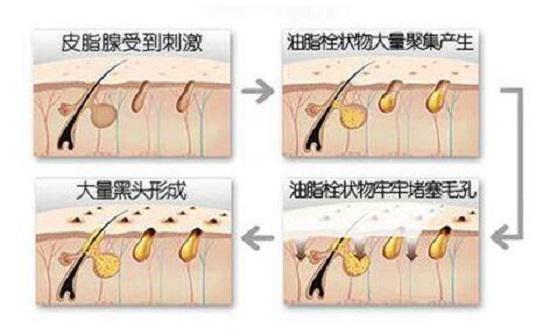 硅油的危害