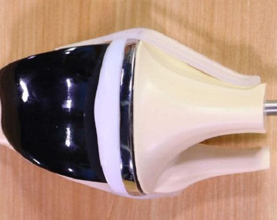 人造膝关节