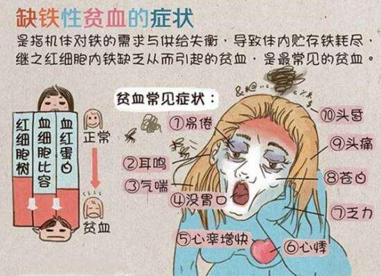 缺铁性贫血的症状