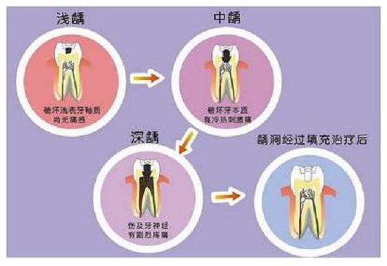 补牙记