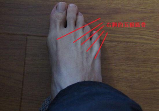 跖骨
