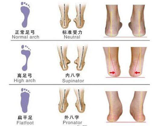 足弓问题