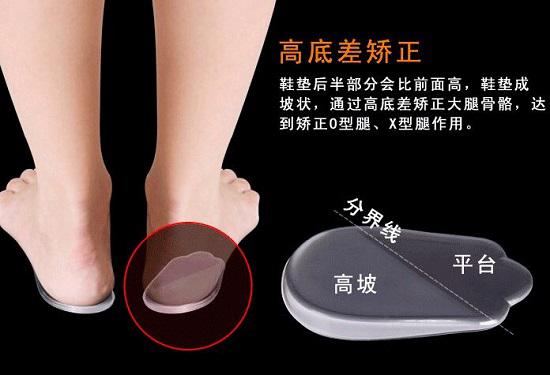 矫正鞋垫