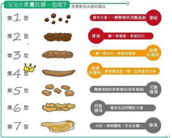 布里斯托大便分类法