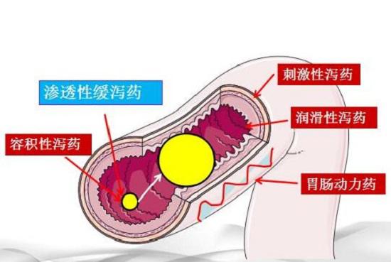 泻剂的类型