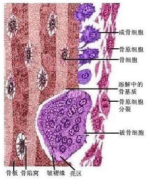 骨骼重建系统