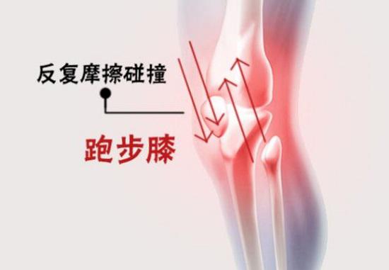 跑步膝