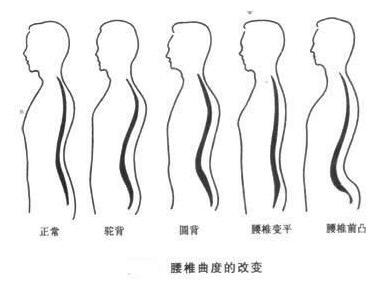 脊柱的曲度变化