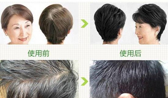 染发
