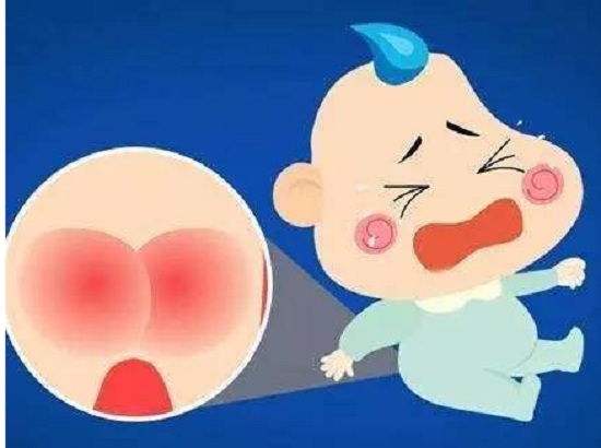 穿使用过的纸尿裤容易红屁屁