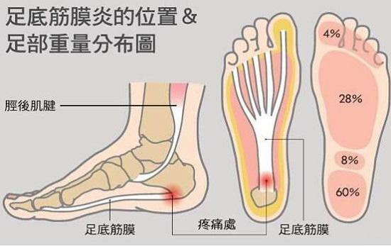 足底筋膜示意图