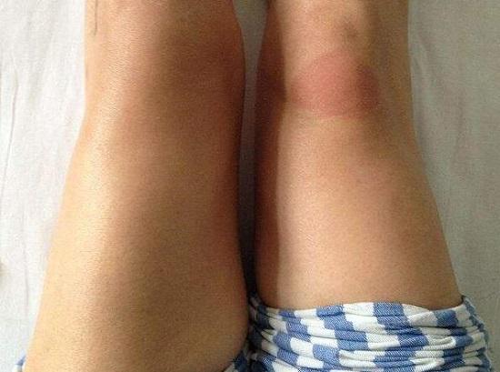 粗细不同的双腿