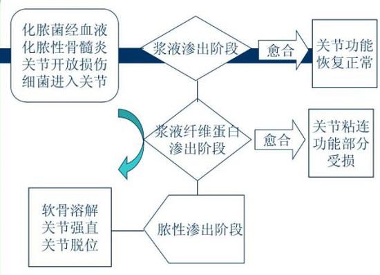 化脓性关节炎