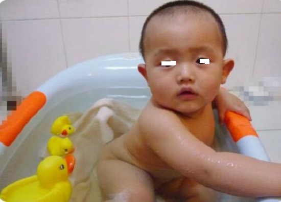感冒