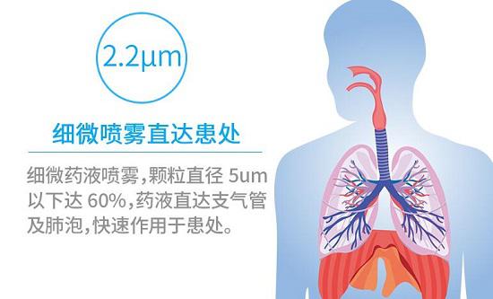 雾化器