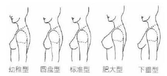 胸形