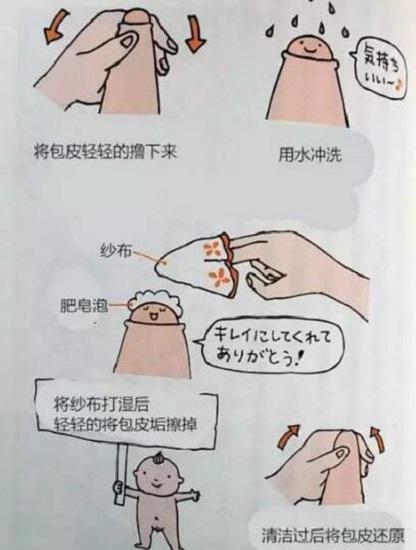 包茎