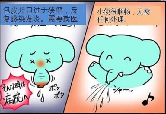 包茎