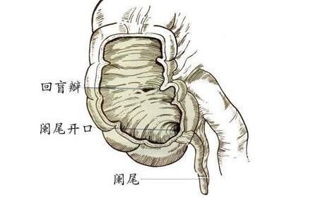 阑尾的构造
