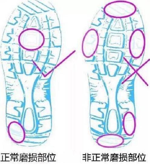 鞋底的磨损部位分布