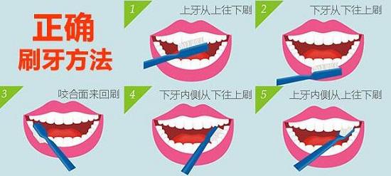 正确刷牙方法