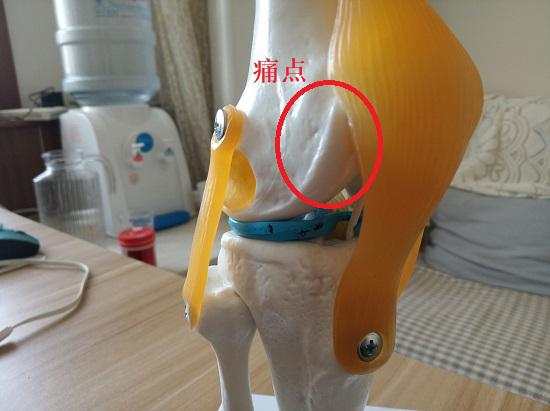 左膝外侧痛点