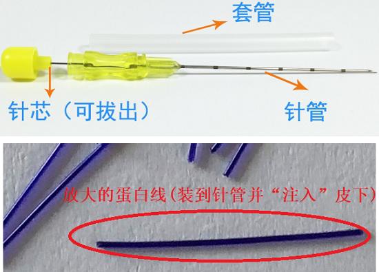 埋线用的工具和材料