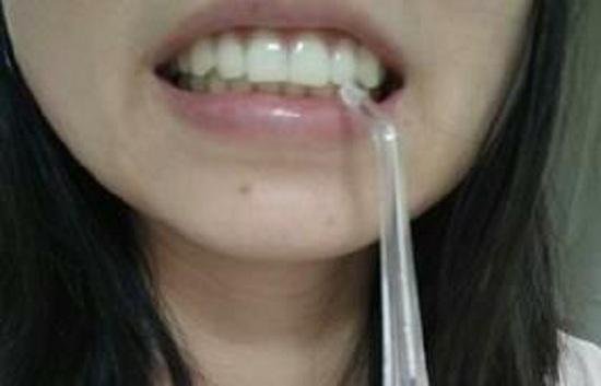 用冲牙器清洁牙齿