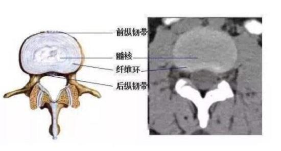 椎间盘周边组织构造