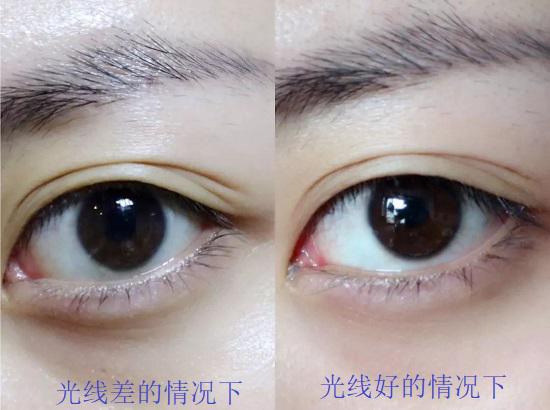 光线差异形成的“黑眼圈”