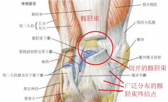 膝关节处的髂胫束