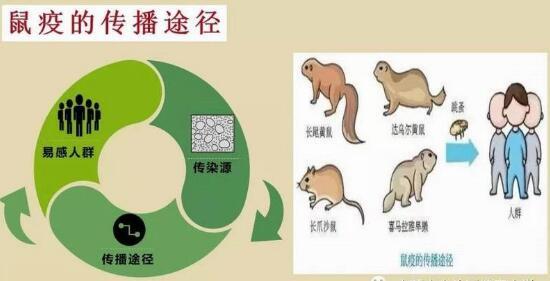 鼠疫