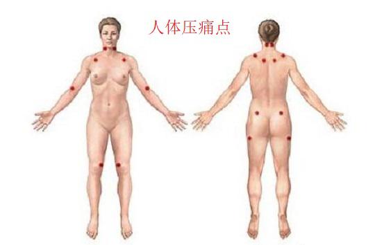 压痛点