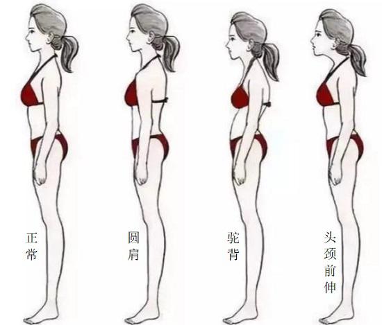 肩的形态