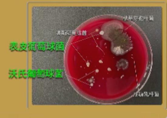 培养皿