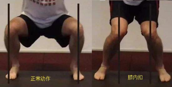 足旋前与膝内扣