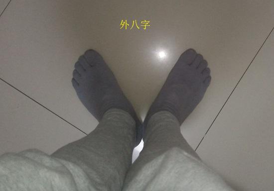 外八字现象